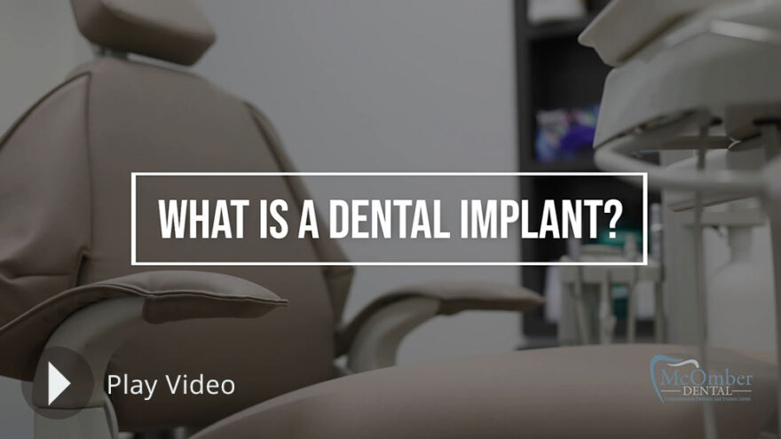 what-is-a-dental-implant-thumb